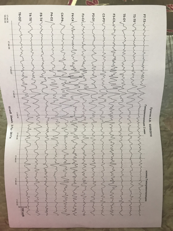 194B3C65-6D92-4157-83C7-7BA7D52C42D2