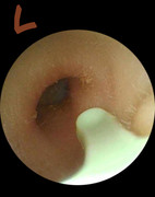 Left-outer