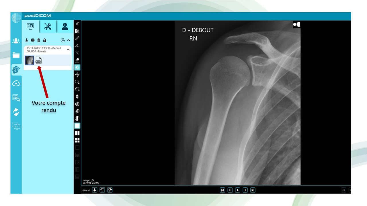 Illustration compte rendu