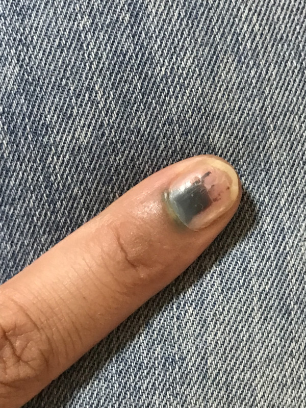 D8394C92-0766-4721-B931-9B5F6F9170A3