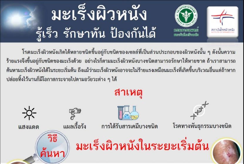 โรคมะเร็งผิวหนัง รู้เร็ว รักษาทัน ป้องกันได้