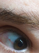 eye2