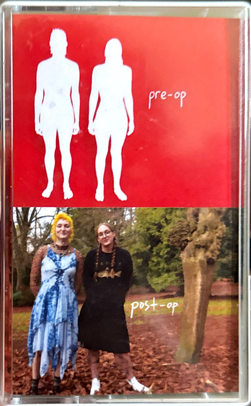 Pre-Op Post-Op Split by Sister Wife Sex Strike - Front Side