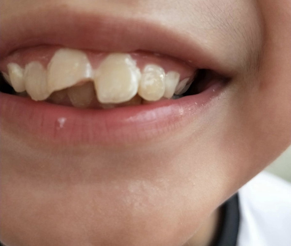 AE273780-385A-426A-AA0B-5F09E00D2DE7