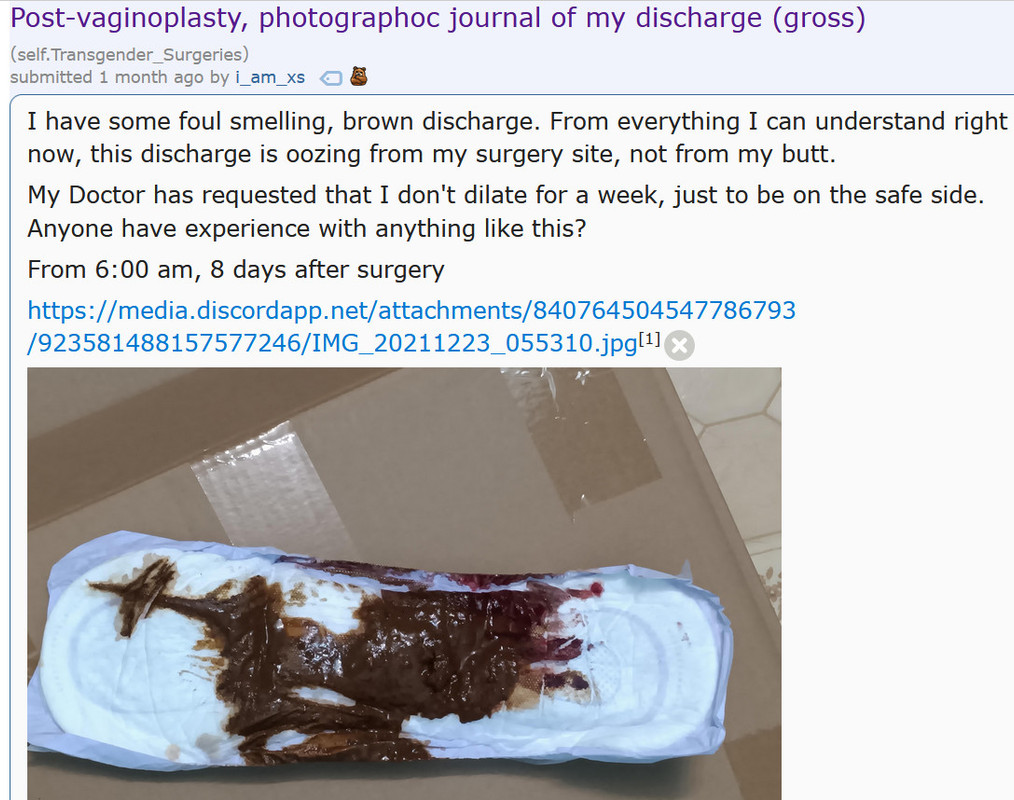 neo vaginal discharge