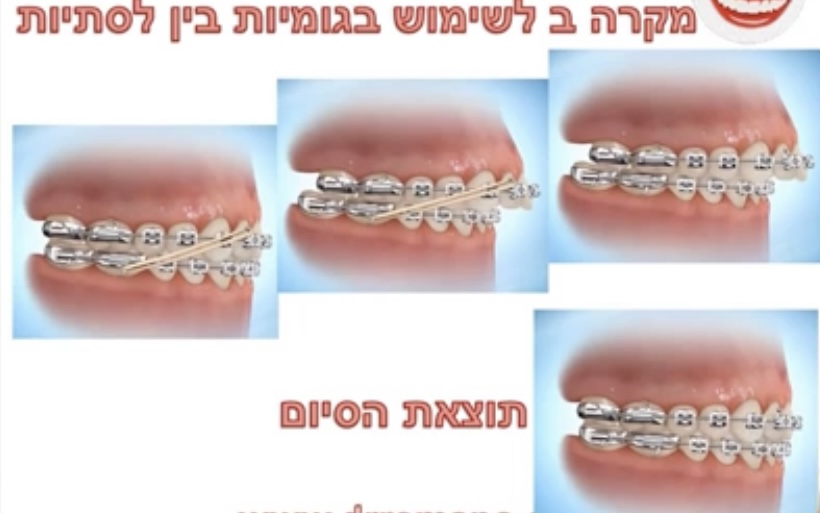 A13781C7-6D36-4F21-BF63-E850EFE6161F