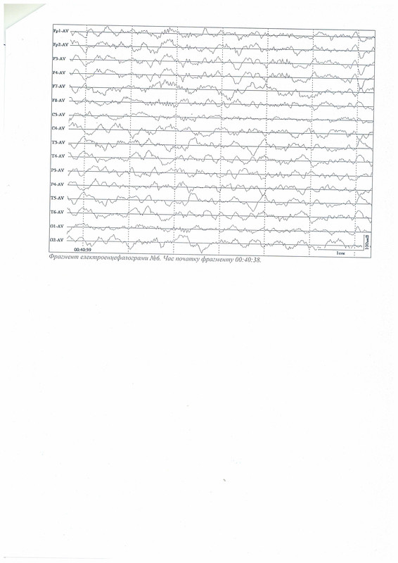 Эхокор стр 5