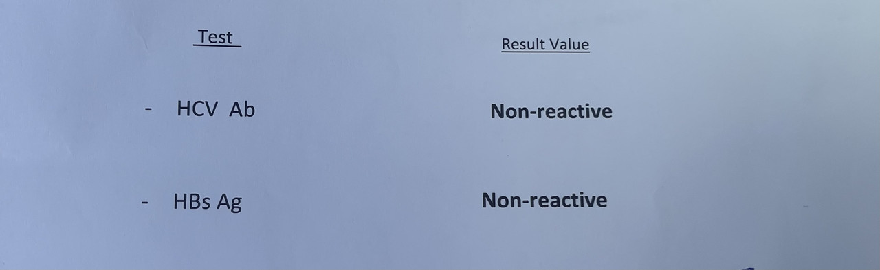 E19107B5-A360-4D75-8CB7-32AC96B7929D
