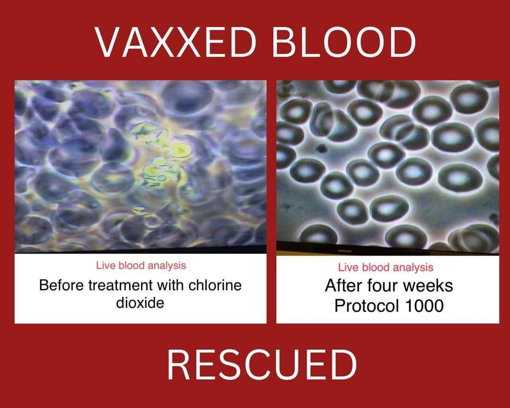 ! ! 00 Rescues Vaxxed Blood