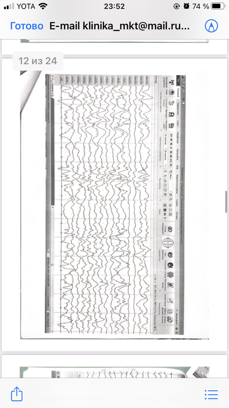 5652C4A9-6838-47CC-88F0-78A5CB2934B9