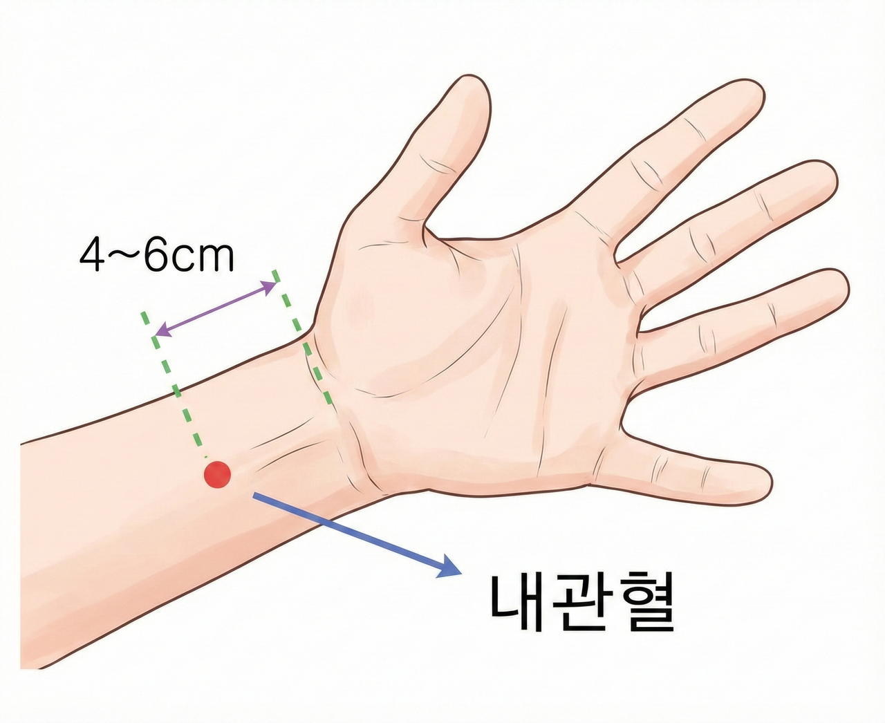 내관 지압점 위치