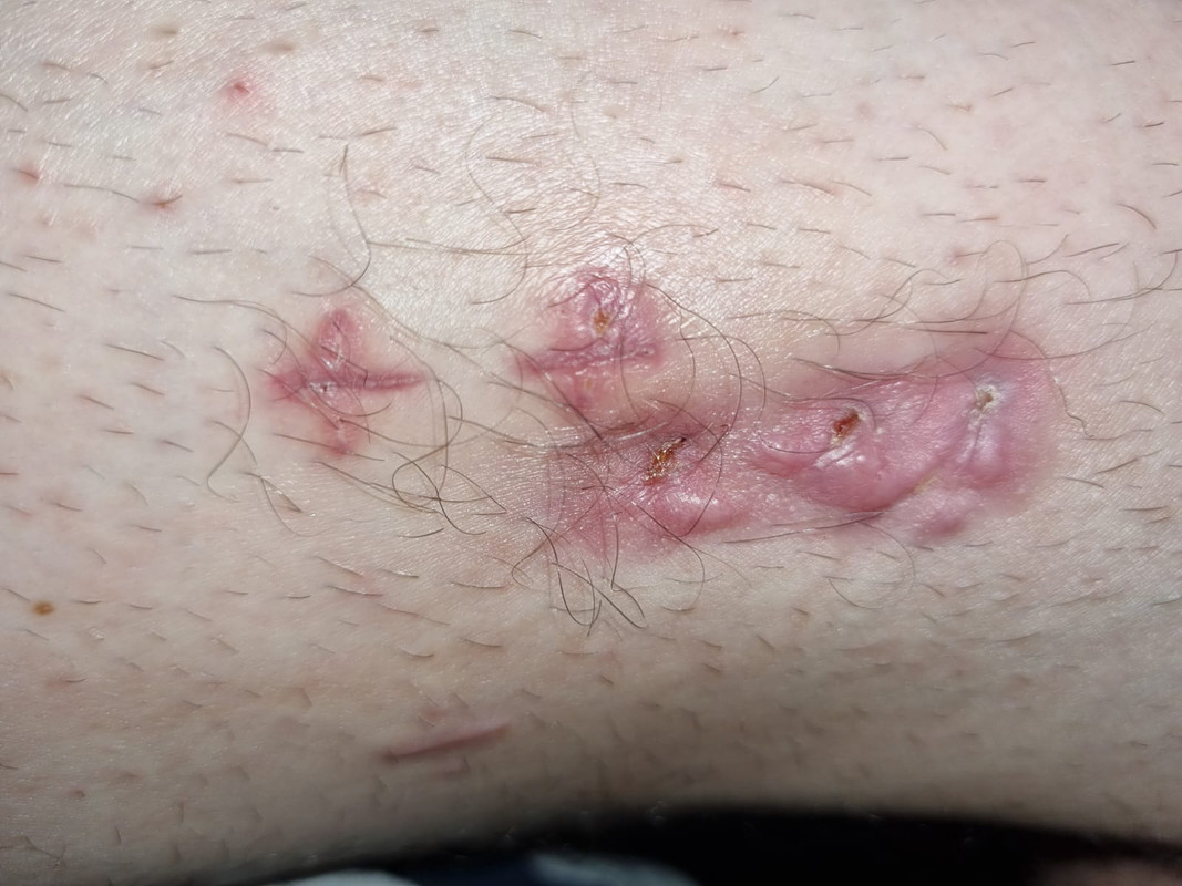 scar02250424