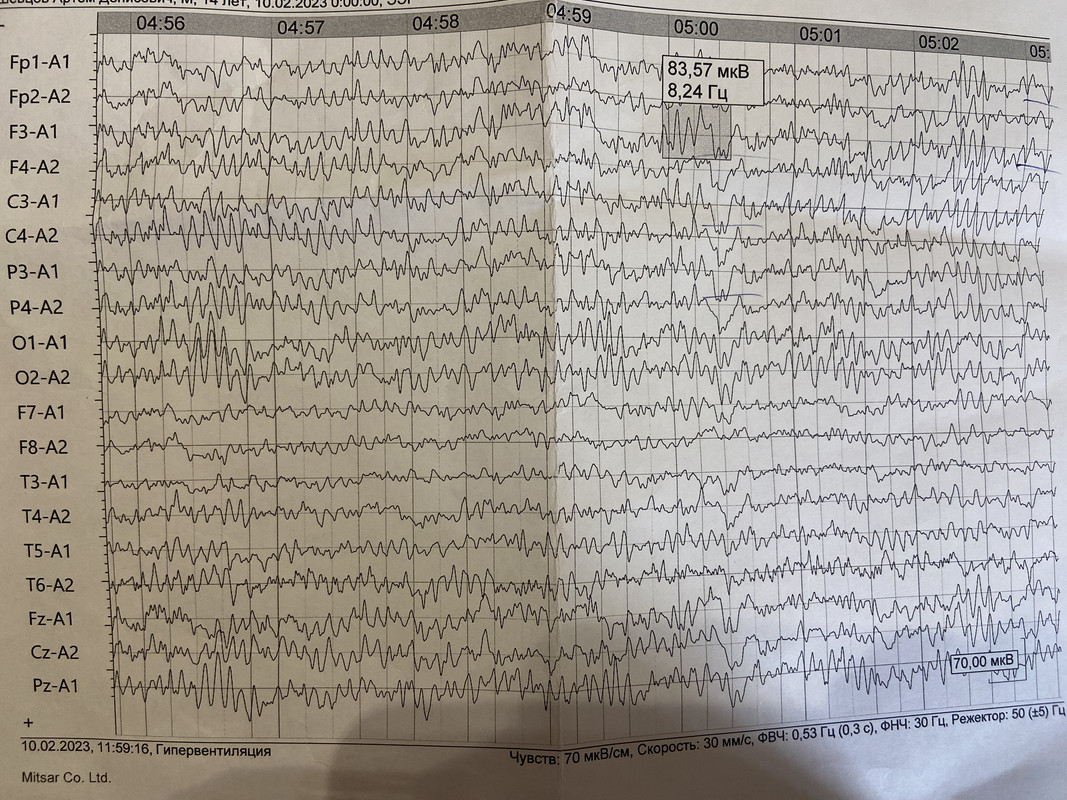 90832A78-AFED-416C-AA06-A017F443431D