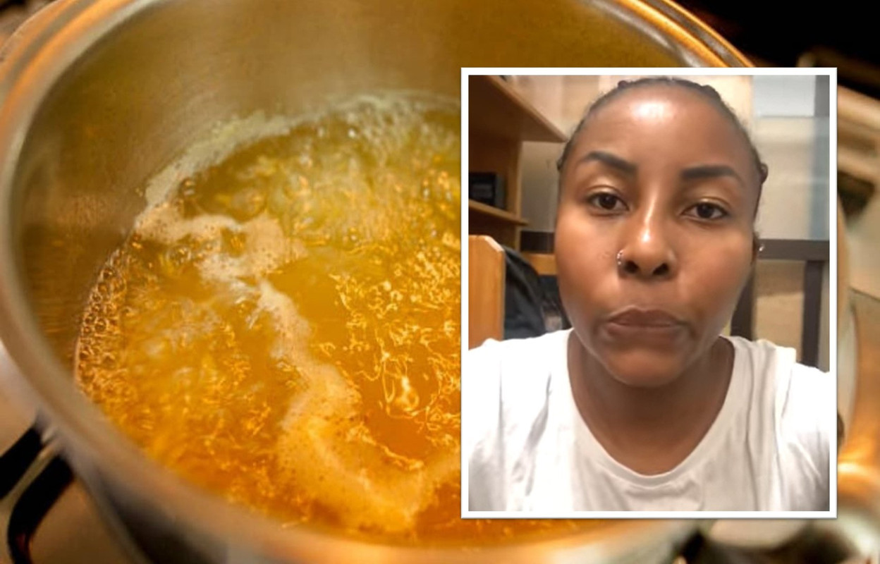 Mujer le quema el rostro con aceite hirviendo a su pareja mientras dormía