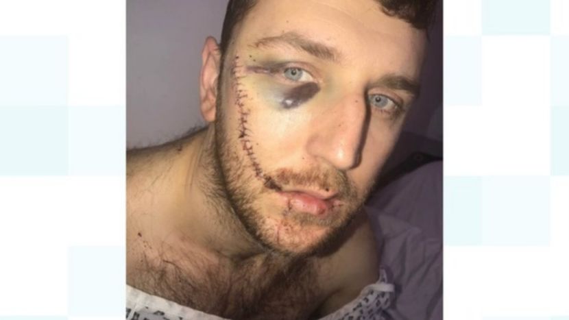 importedImage299522_header