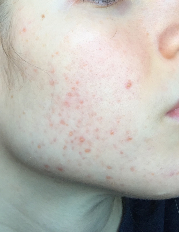 DB622F66-8F23-4855-B764-F35098899F5B