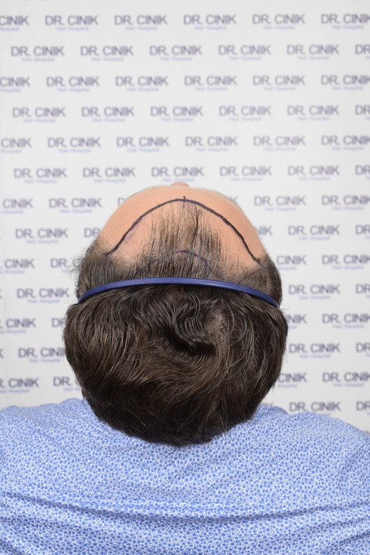 photos préopératoires (6)