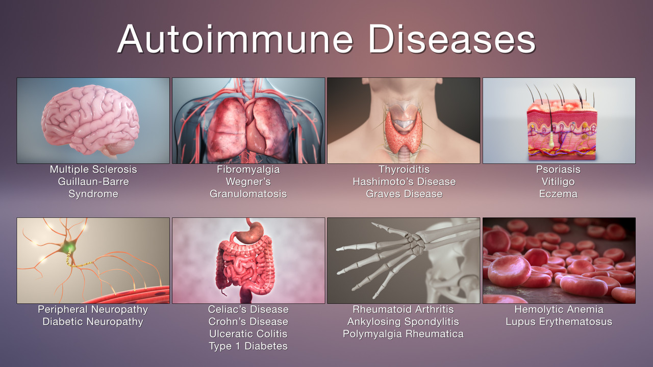 Autoimmune Disease Overview