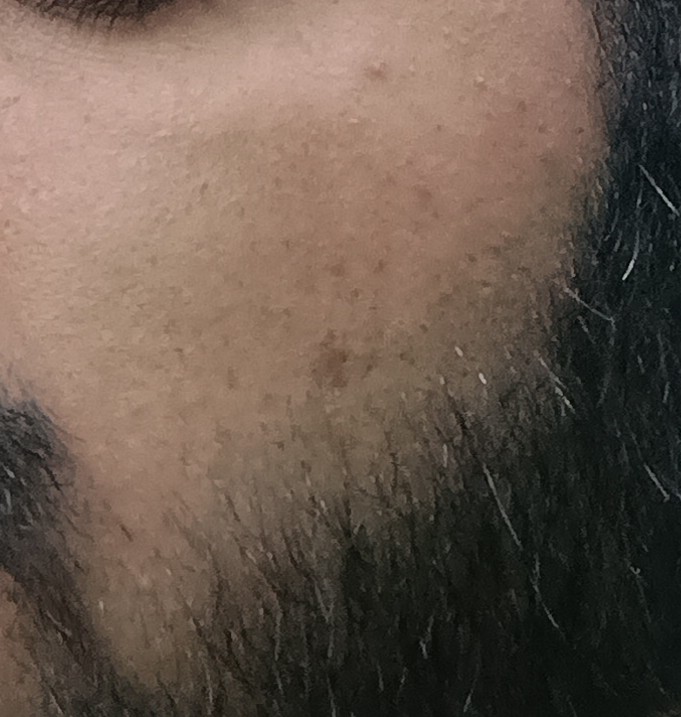 IMG_20250418_124155043_HDR