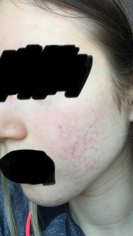 3EA84495-C4F2-470D-A710-799E172840FE