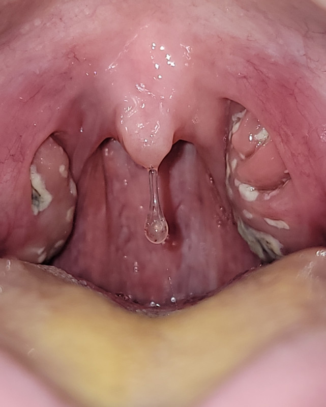 Screenshot_20220228-182448_Gallery