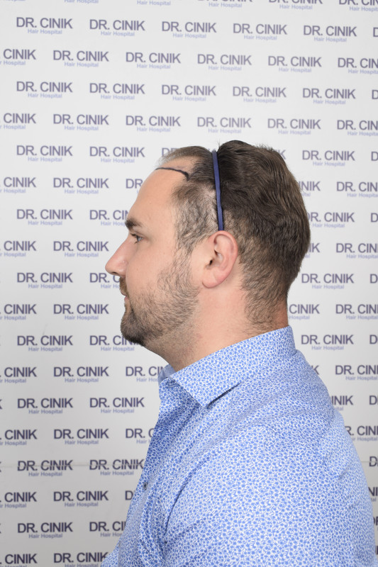 photos préopératoires (2)