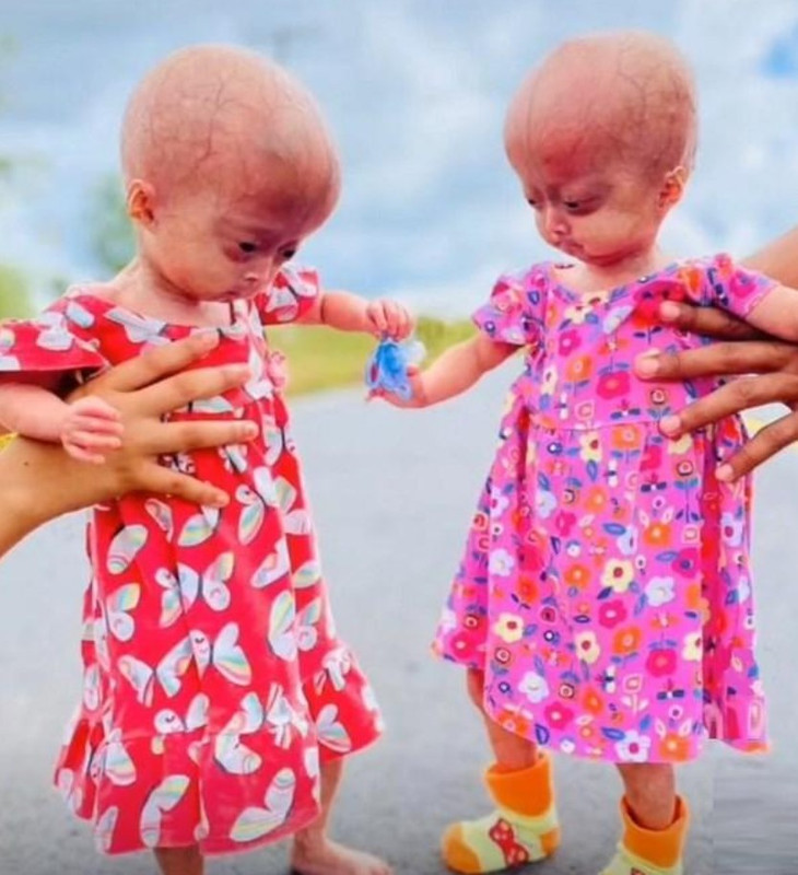 Elis e Eloá lado a lado em foto tirada pela família – Foto: Arquivo Pessoal/Guilherme Lago