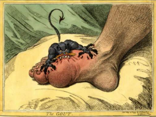 Let me Entertain You Gillray-the-gout