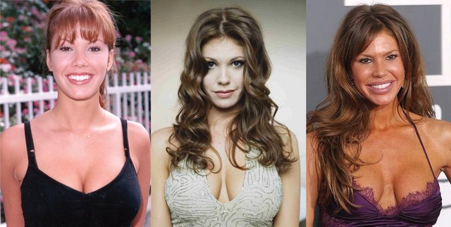 nikki-cox-plastic-surgery.jpg