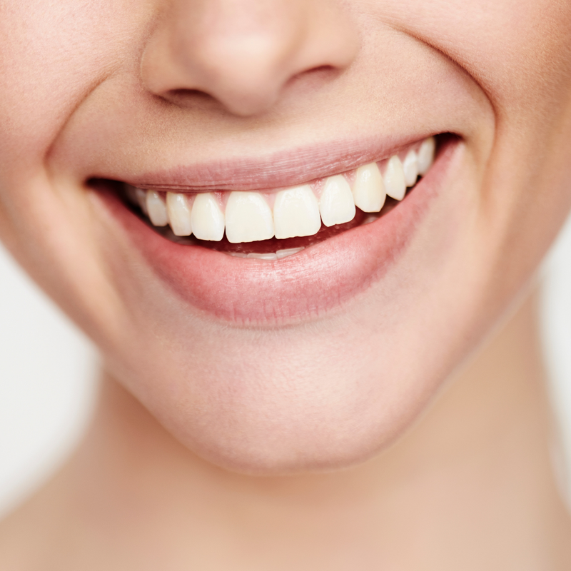 Paziente che sorride dopo il trattamento dentale Sanident a Napoli