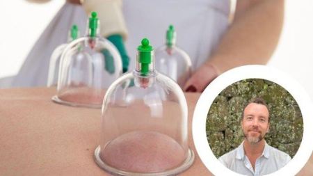 Learn Chinese Cupping Therapy Release Muscle Tension Fast