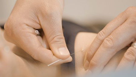IMS Dry Needling for Healthcare Professionals