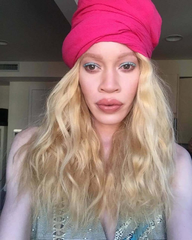 Афроамериканская модель с альбинизмом поразила всех своей необычной внешностью