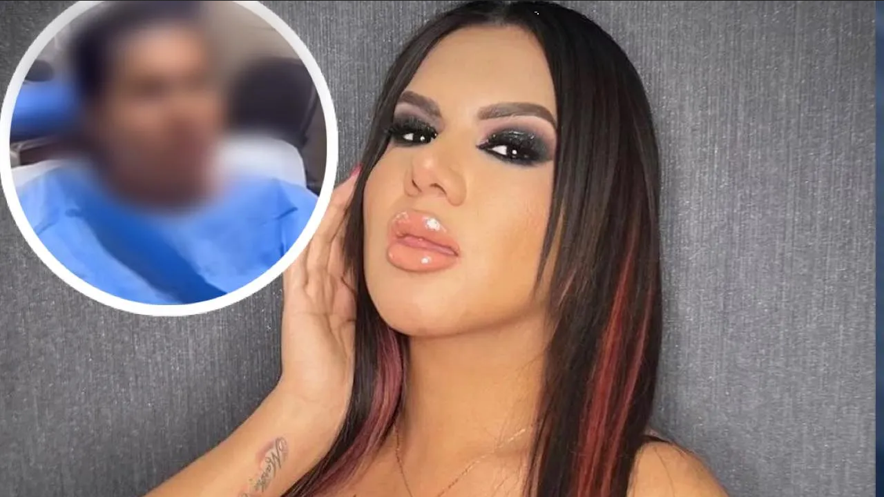 Kimberly Irene se somete a un injerto de cabello y le llueven críticas; así luce