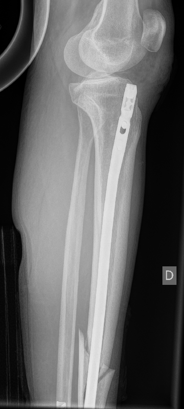 22 12 25 golen lat 1