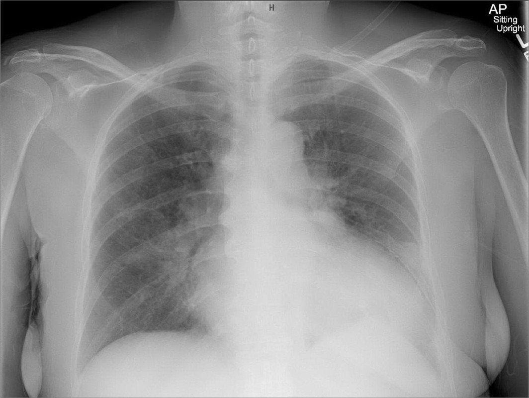 Cardiology question 8 image