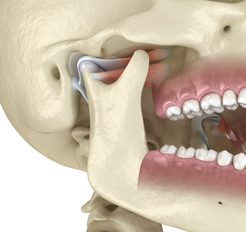 Articulation Temporo-Mandibulaire
