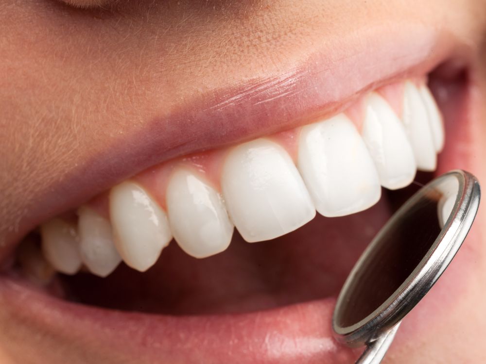 Dental Crowns in Dubai: How They Can Improve Function and Aesthetics