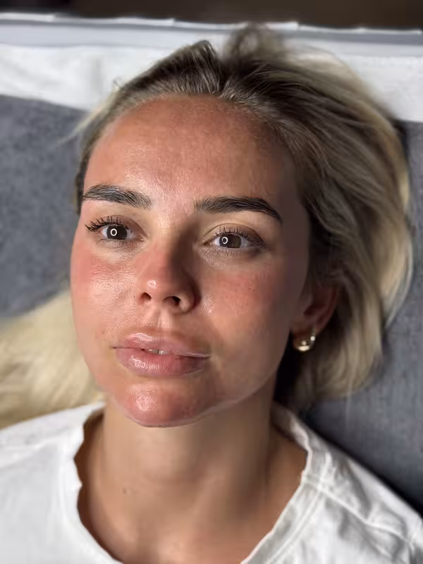Popis obrázku