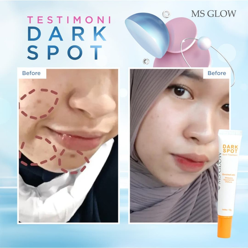 testimoni ms glow skin care