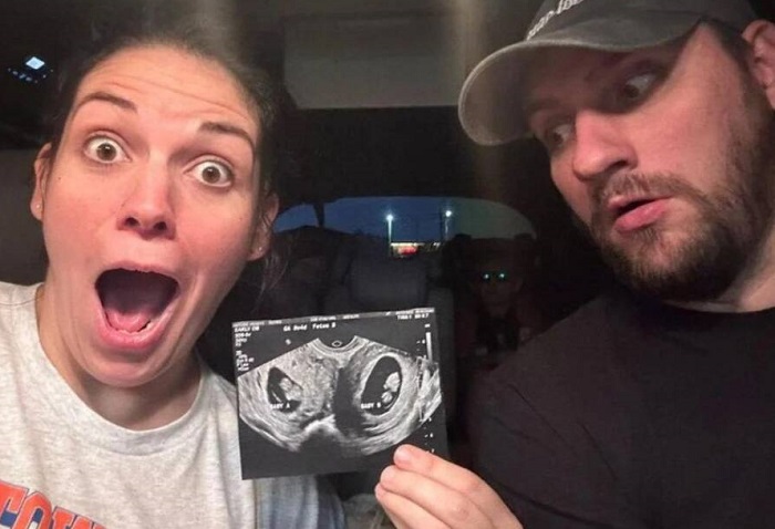 Kelsey Hatcher, seorang wanita berusia 32 tahun dari Alabama, lahir dengan dua rahim. Uniknya kini ia dinyatakan hamil pada kedua rahimnya.