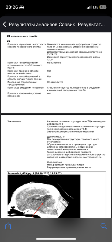0ED5963A-27D8-4651-ABF6-FB09A386414B