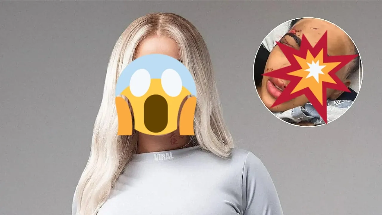 Tras brutal golpiza, famosa cantante se encuentra delicada en un hospital