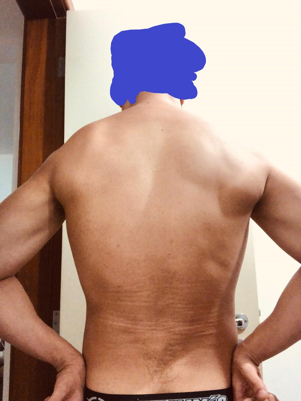 spacer.png
