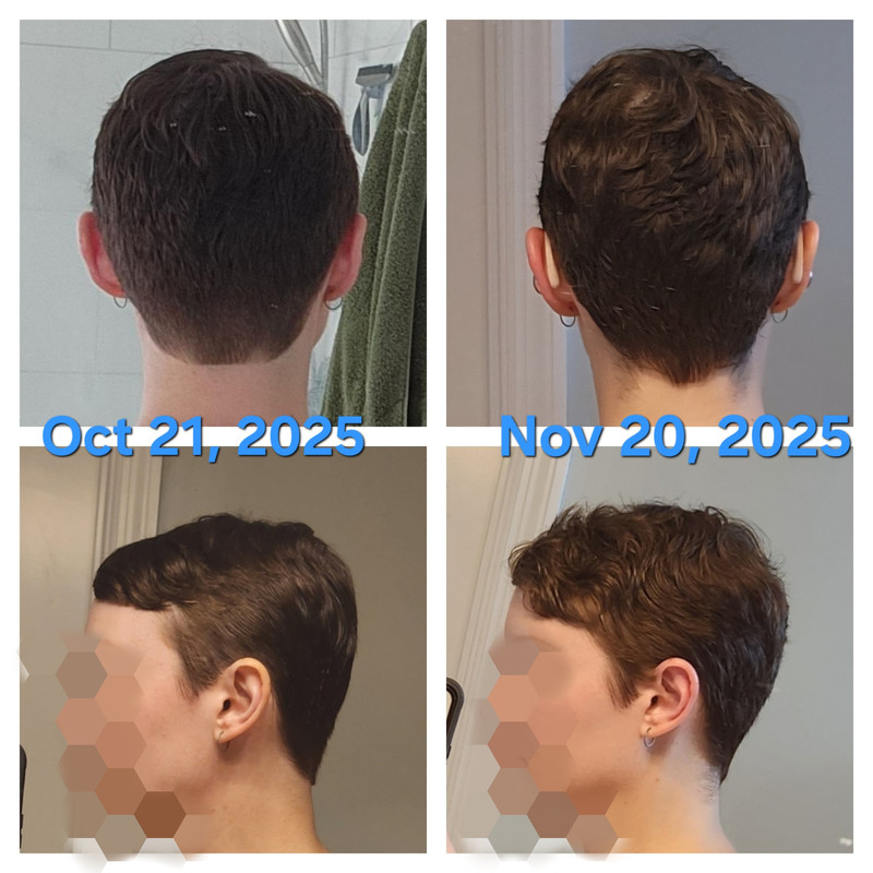 Point Blur Nov202025 122439