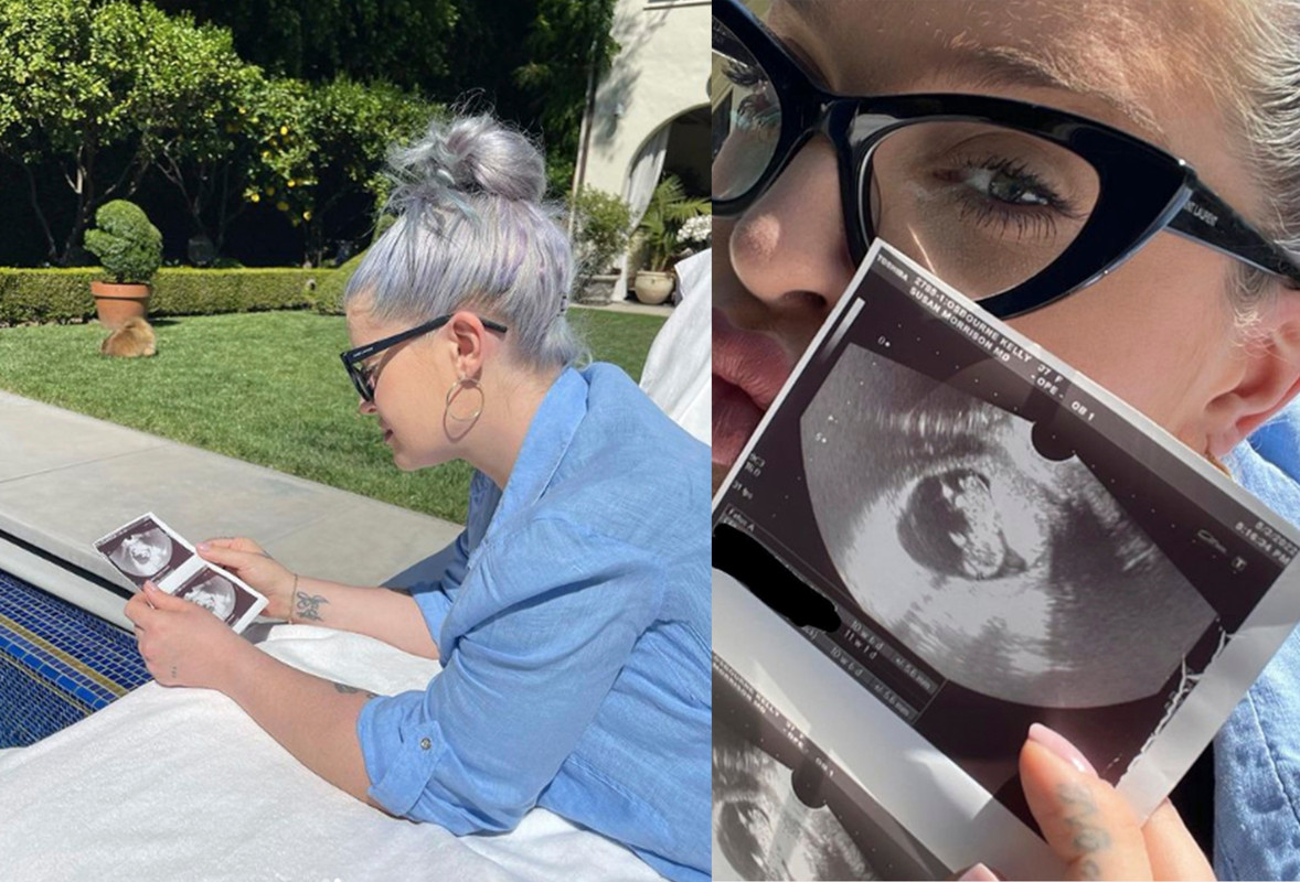 Kelly Osbourne anuncia que tiene diabetes gestacional mientras está embarazada