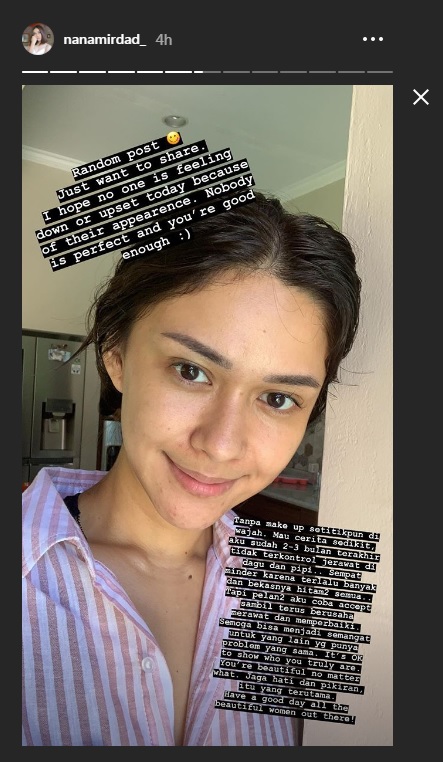 Instagram Story