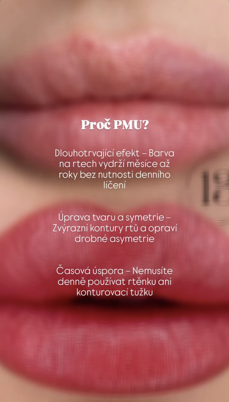 Popis obrázku