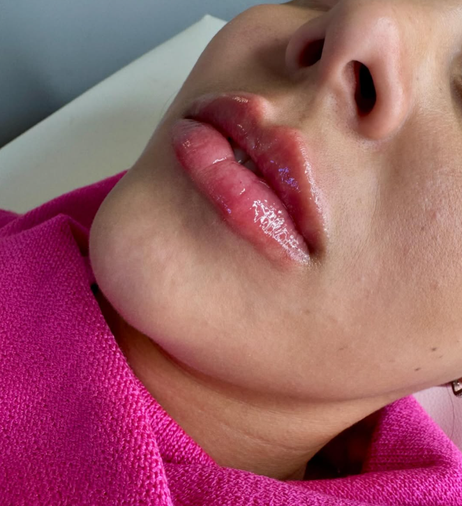 Resultado de tratamento