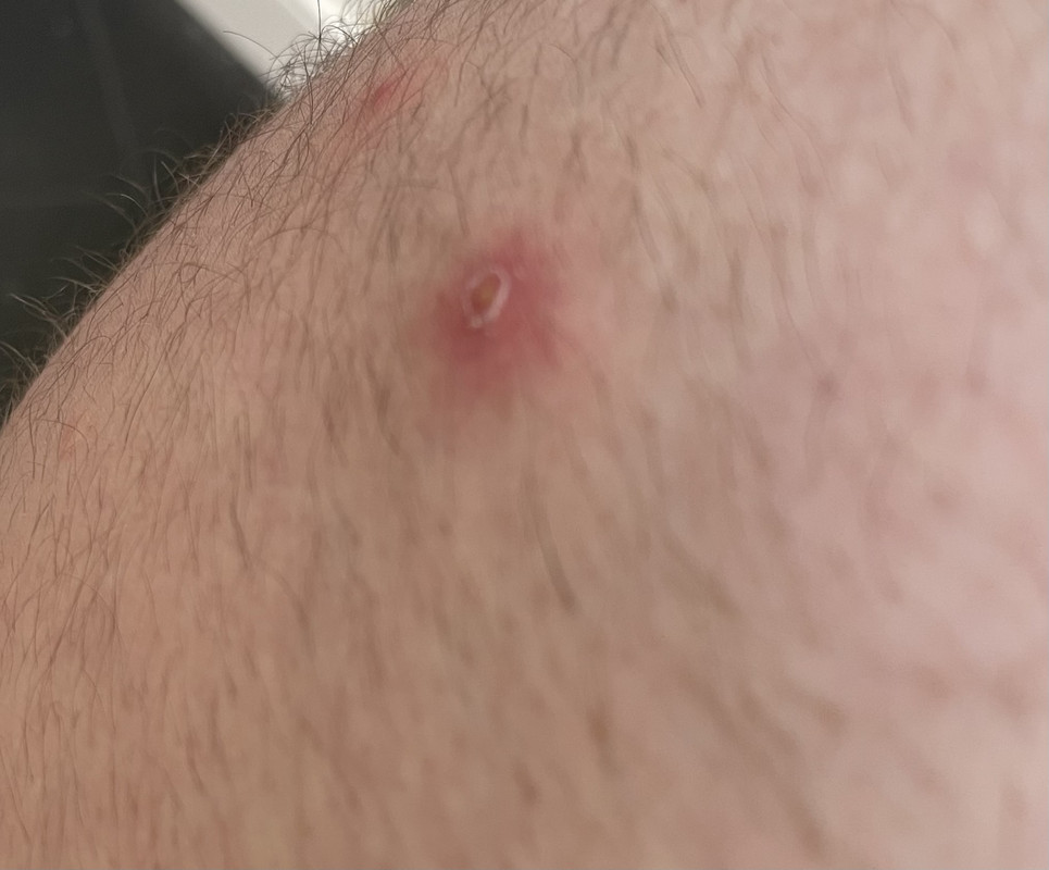 CF0DF70B-3F42-4A5B-A0DA-D81E7CCF2E26